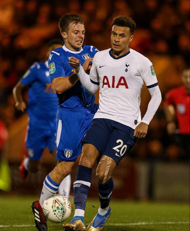 记者：卡马文加腿筋疼痛，可能缺席法国与乌克兰的比赛（记者称卡马文加腿筋不适，恐无缘法国对乌克兰之战）